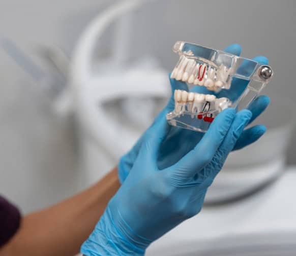 Implantologia dentale